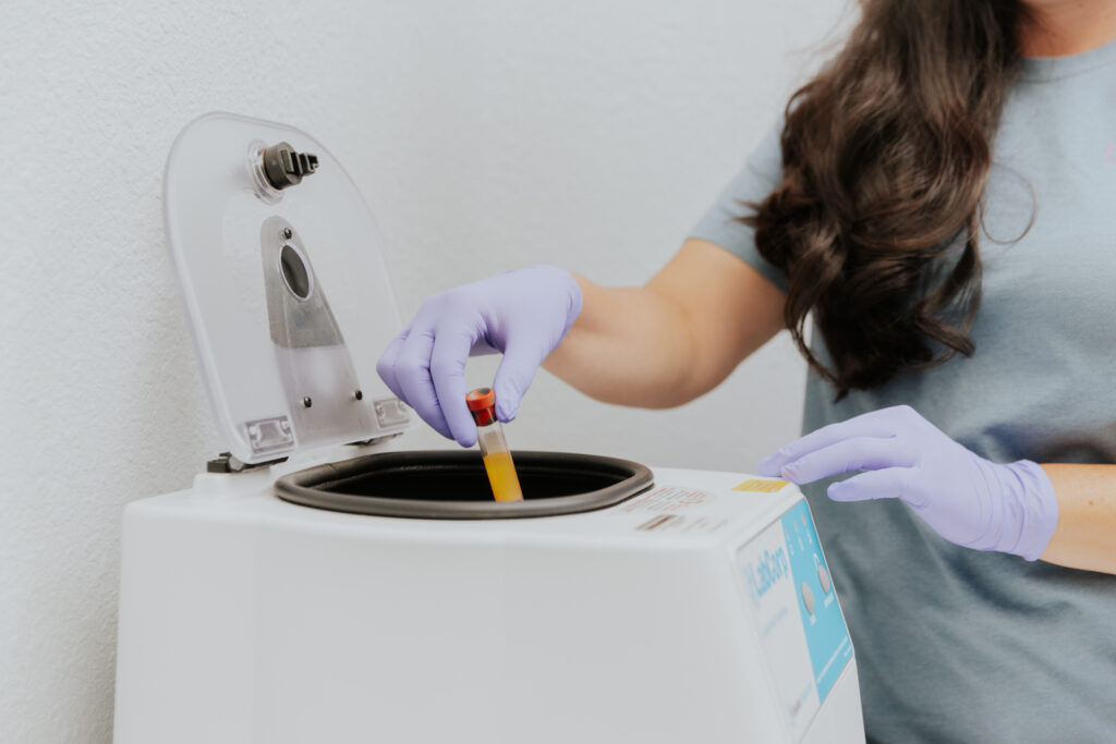 A provider puts a test tube into a lab device. This in-office testing helps us gather data on hormone levels to see if hormone therapy in Canton is suitable treatment.